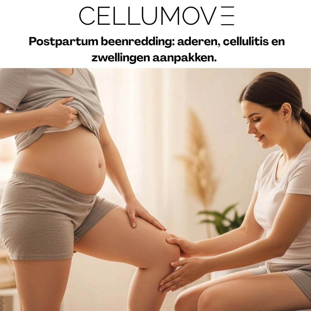 e-bog: "Postpartum Beenherstel: De Aanpak van Aders, Cellulitis en Zwelling."